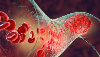 transfusao-inedita-de-sangue-criado-em-laboratorio-e-realizada