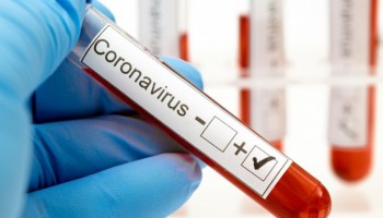 itapolis-registra-o-3o-obito-por-covid-19