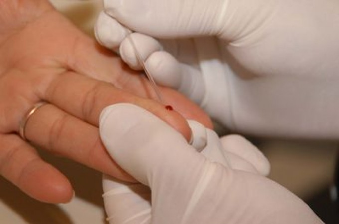 SAMS realizar teste de Hepatite at o dia 26