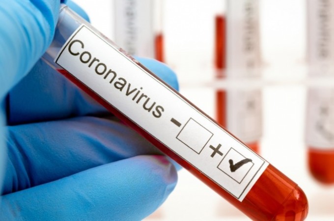 Itpolis confirma o 5 bito por COVID-19